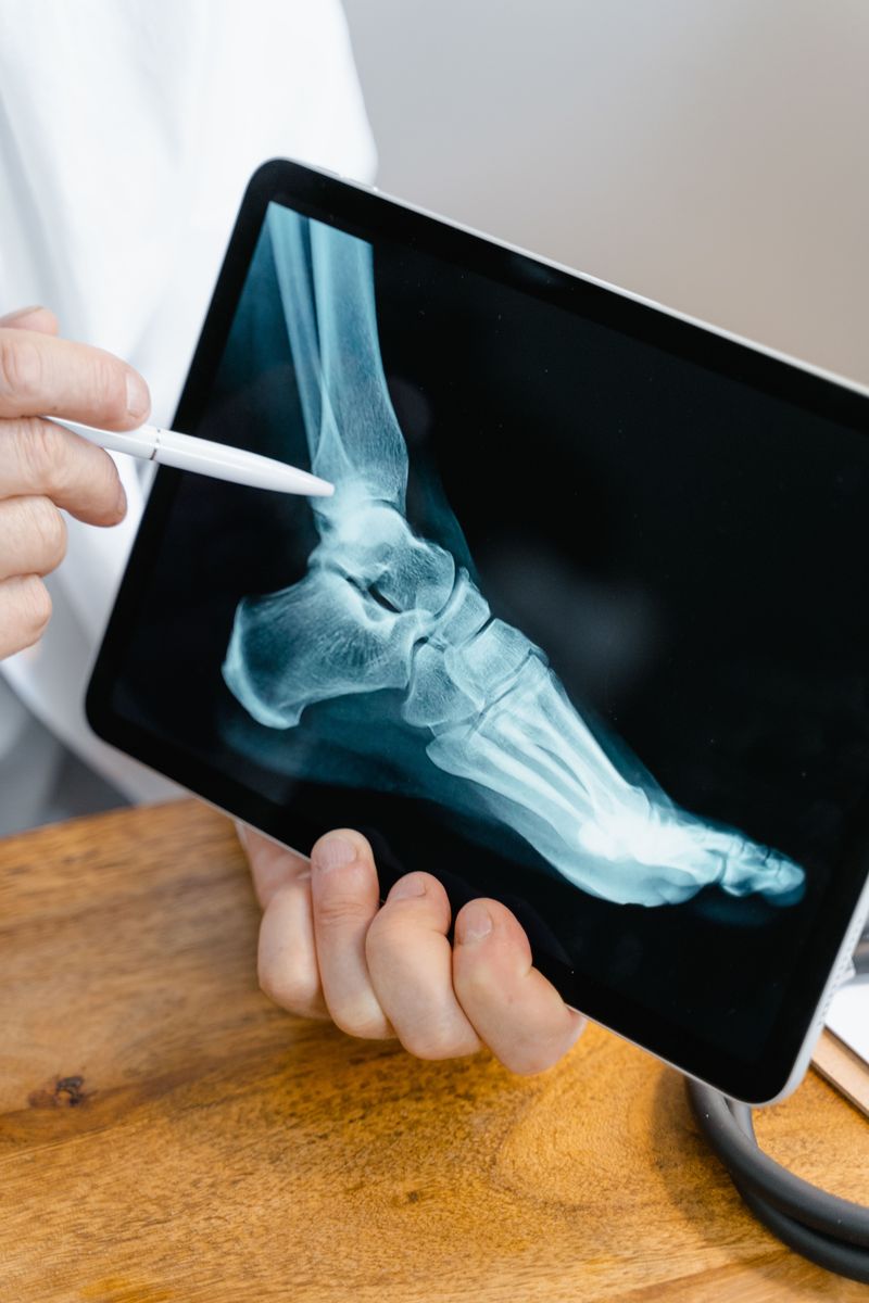 A clinician pointing to a foot X-ray on a tablet